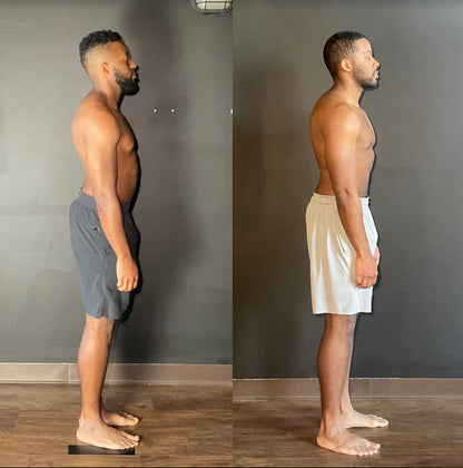 Posture Corrector